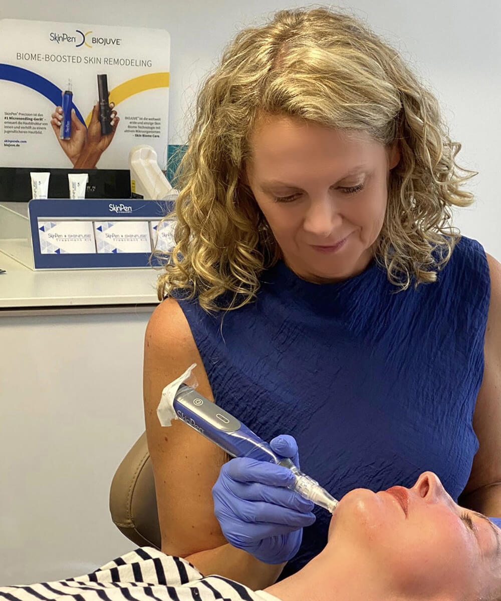 Dr. Silke Späth führt eine Microneedling Behandlung in ihrer Praxis in Düsseldorf durch